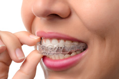 Invisalign Orthodontics